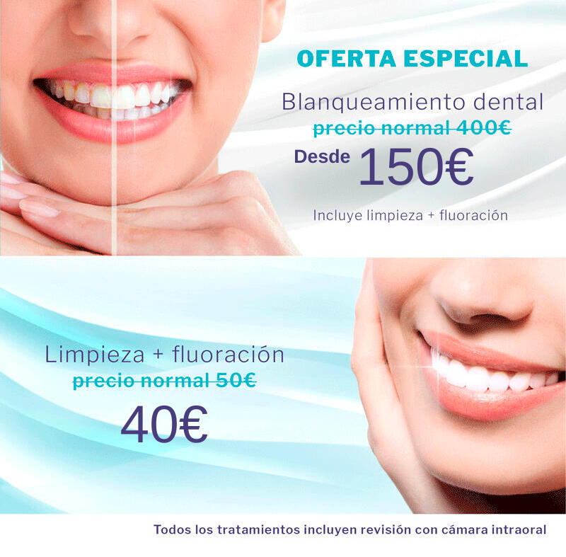 Oferta de blanqueamiento y limpieza